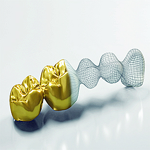 Wir verarbeiten noch immer mit Gold, nur anders!